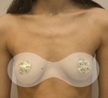 Увеличение груди в рамках проекта о преображении - До