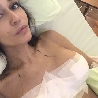 Алена Водонаева, фото после уменьшения груди