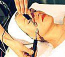 Миостимуляция для лица что это. Смотреть фото Миостимуляция для лица что это. Смотреть картинку Миостимуляция для лица что это. Картинка про Миостимуляция для лица что это. Фото Миостимуляция для лица что это