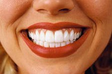 Отбеливание зубов в стоматологии "Медицинский центр Европа М"