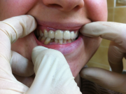 Протезирование зубов в стоматологии "Медицинский центр Европа М"