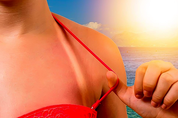 Может ли крем для бритья вылечить солнечный ожог? thumbnail