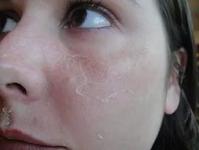 Маска от шелушения кожи лица отзывы thumbnail